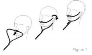 Place el nasal cannula kits onto thepaciente como se muestra en Figure 2. Place el nasal cannula kits onto thepaciente como se muestra en Figure 2.