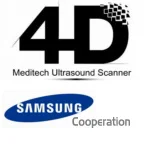 4D escáner de ultrasonido 4D escáner de ultrasonido