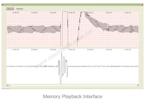 memoria Playback incluye ECG, grid, speech forma de onda, corresponding time mark, Auto play botón, and botón para printing current page.