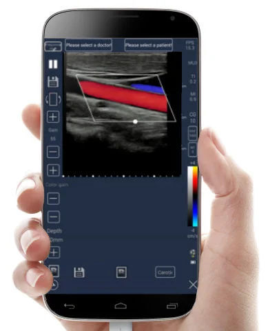 Meditech tablet escáner de ultrasonido, color doppler,android doppler,iphone escáner de ultrasonido