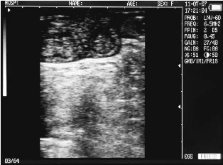 Sonovet escáner de ultrasonido Sonovet escáner de ultrasonido